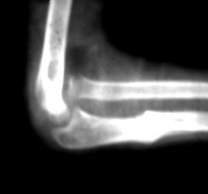 reciclaje de radiografias radiografia